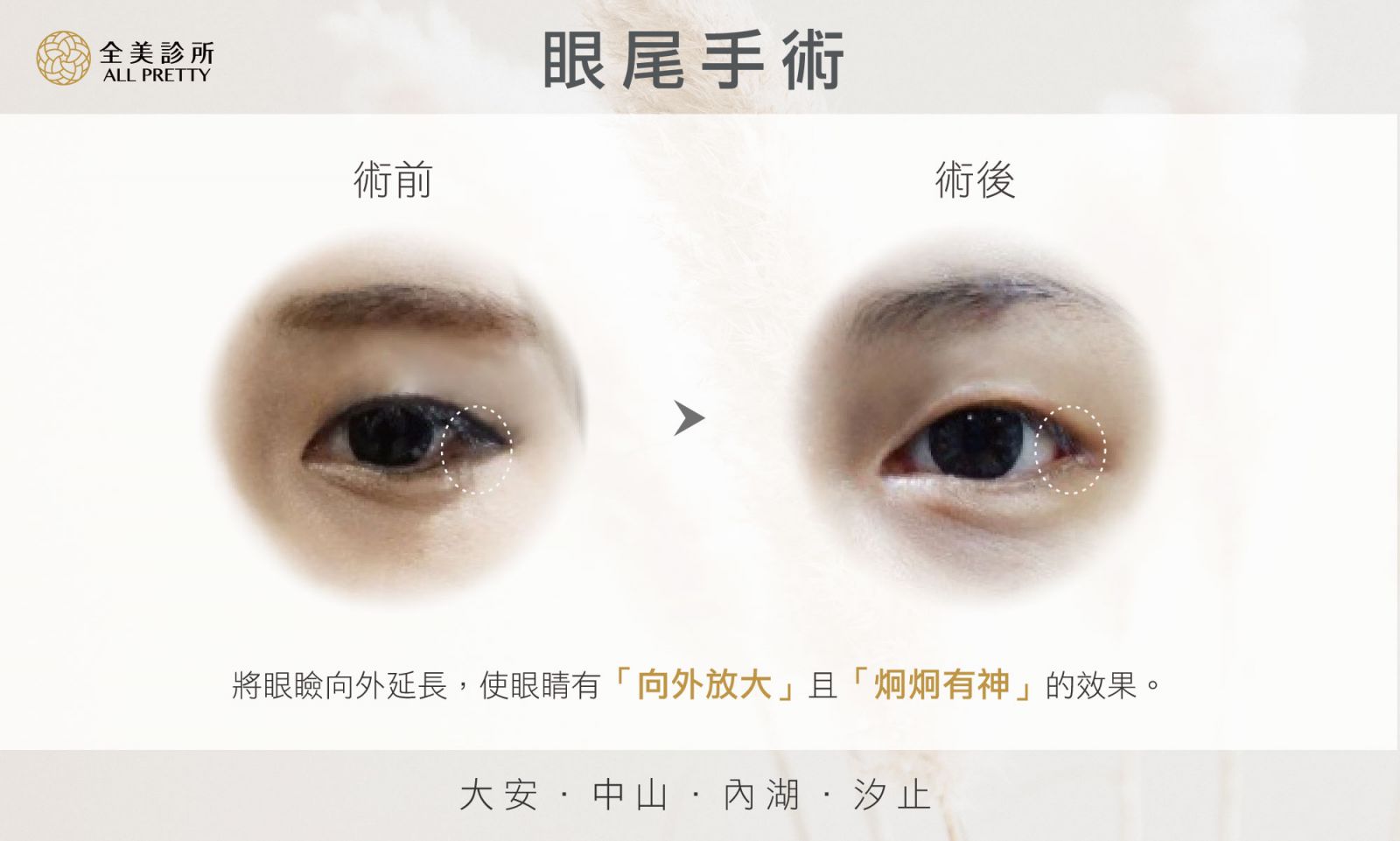 開眼尾示意圖.jpg 開眼尾示意圖.jpg